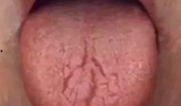 吃小瓜舌头裂纹,揭秘小瓜的秘密