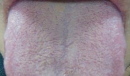 吃小瓜舌头裂纹,揭秘小瓜的秘密